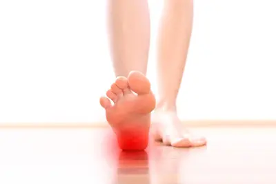 Educational visual for plantar fasciitis heel pain assessment at Merivale Clinic in Ottawa